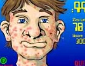 Acne be gone - Like many of us, this poor dude is afflicted with an acne problem. Health Straight Up is here to help! Click the zits on the dude’s face to make them go away forever. You have only 99 seconds to do it! So stupid game :)
