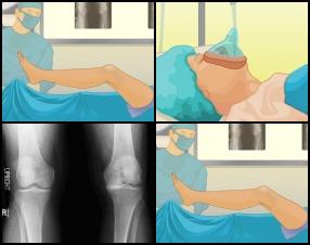 This game will show you almost whole procedure of knee surgery. Take a part in this realistic surgery game and become a doctor and perform knee surgery on a patient. Use your mouse to control the game.